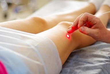 Terapia a laser